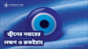 জ্বীনের নজরের লক্ষণ ও রুকইয়াহ