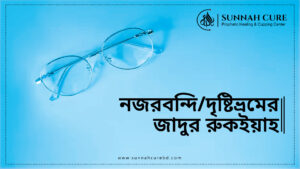 নজরবন্দীরে যাদুর রুকইয়াহ