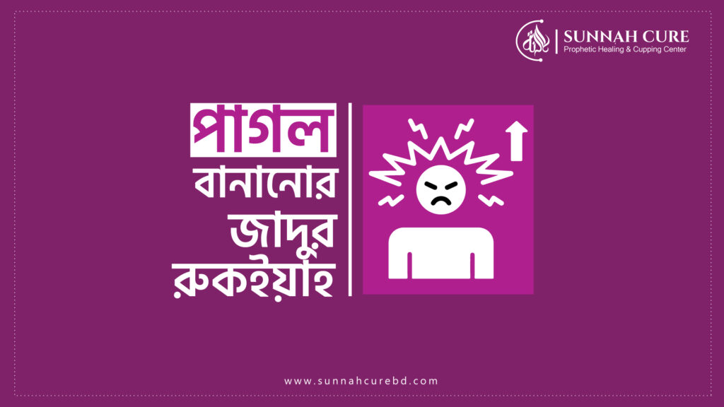 পাগল বানানোর যাদুর রুকইয়াহ