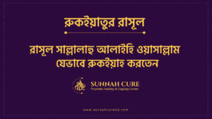 রাসুলুল্লাহ সাল্লাল্লাহু আলাইহি ওয়াসাল্লাম যেভাবে রুকইয়াহ করেছেন